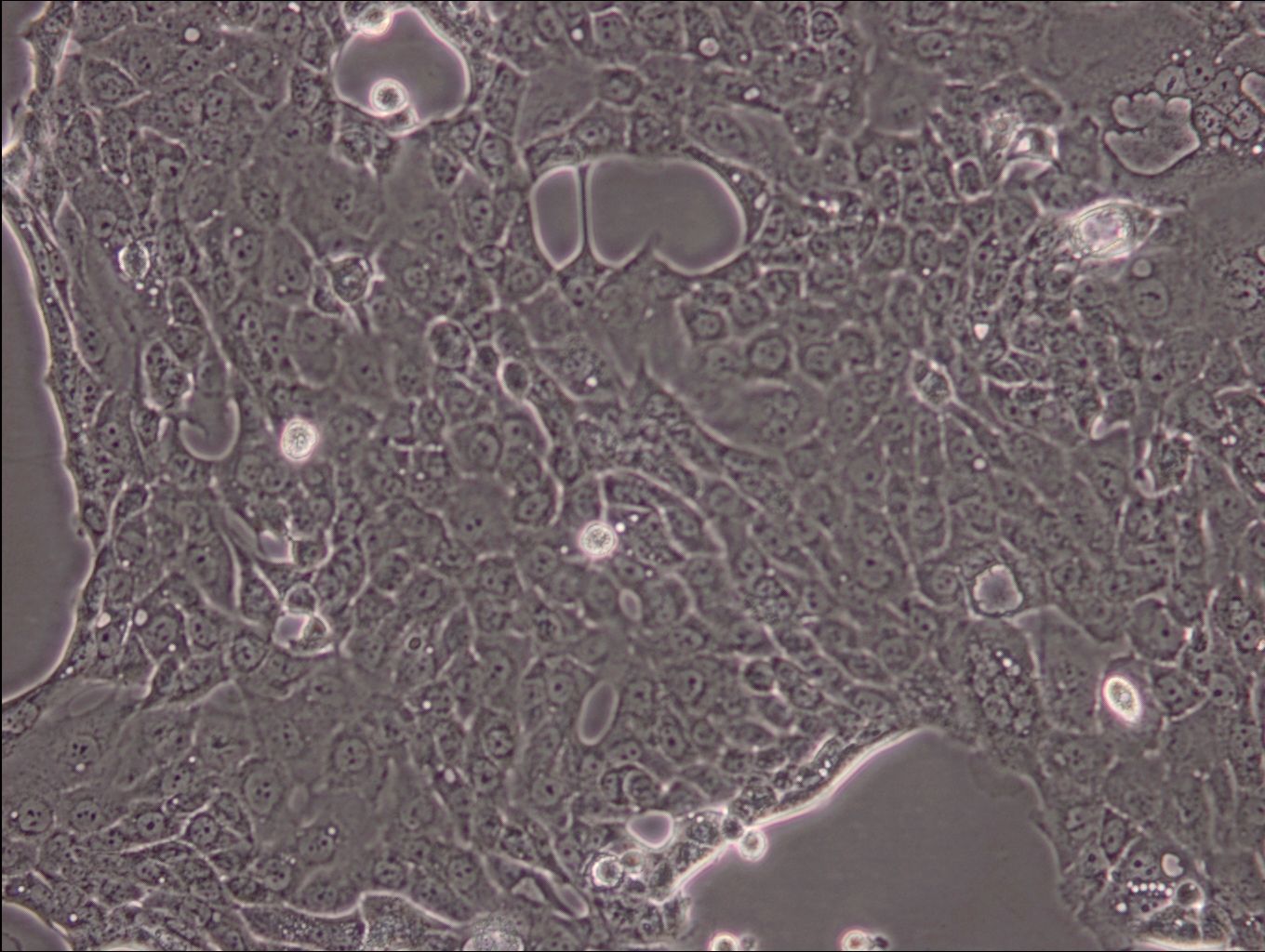 人胰腺导管癌细胞CFPAC-1(STR鉴定正确)