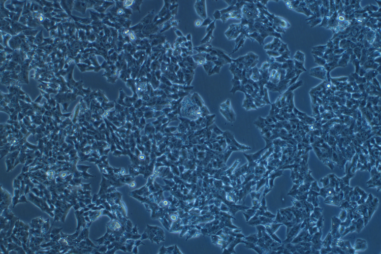 人肾上腺皮质腺癌细胞NCI-H295R(STR鉴定正确)