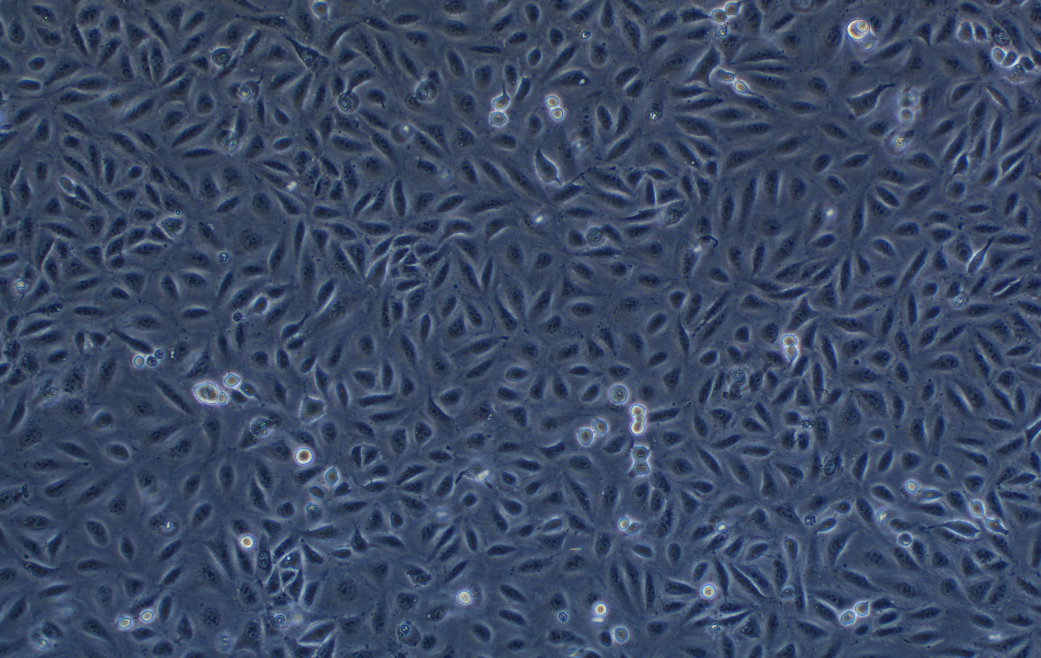 人肺腺癌耐顺铂株A549/DDP(STR鉴定正确)