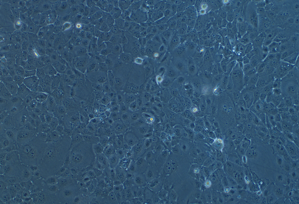 人胰腺癌细胞系SW 1990(STR鉴定正确)