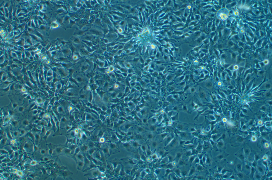 人肺鳞癌细胞HCC1588 (STR鉴定正确)