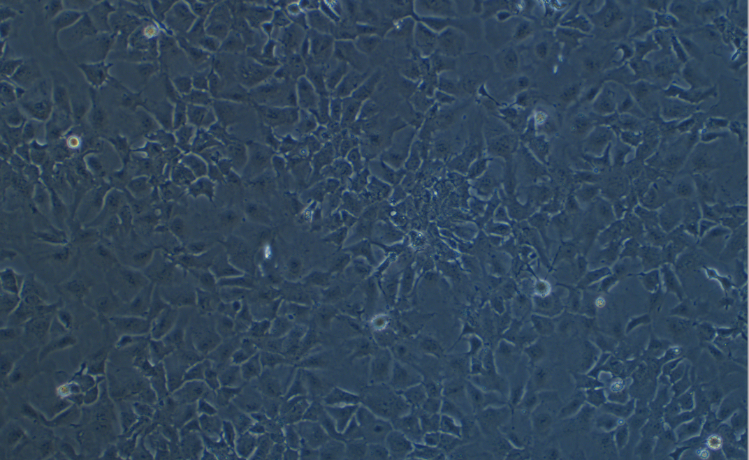 人肝癌细胞Hep 3B2.1-7(STR鉴定正确)